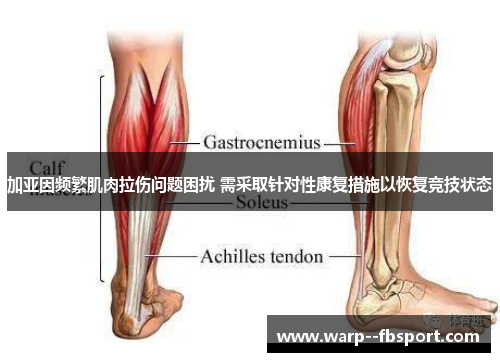 加亚因频繁肌肉拉伤问题困扰 需采取针对性康复措施以恢复竞技状态 加亚因频繁肌肉拉伤问题困扰 需采取针对性康复措施以恢复竞技状态